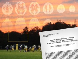 Football Field with Brain trauma scan overlay